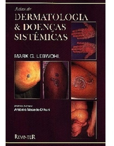 Atlas De Dermatologia E Doencas Sistemicas - Lebwohl