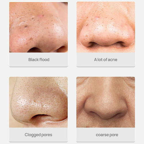 Para . Kr 2lambena Mascarilla Limpiadora Desmaquillante