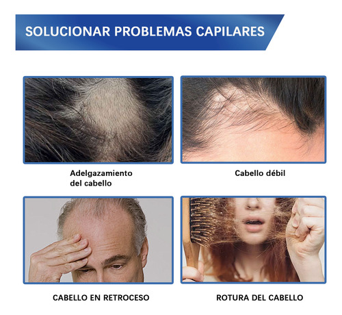 Spray Minoxidil 5% Crecimiento Sérum Para Cabello Y Barba