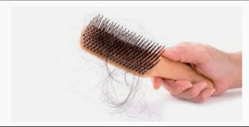 Imagen 2 de 4 de Shampoo Herbal Anticaida De Cabello