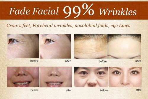 Masajeador Lifting Facial