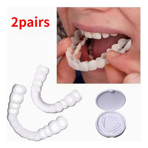 Snap-in Smile Brackets De Dentadura Sin Agujeros 2pcs