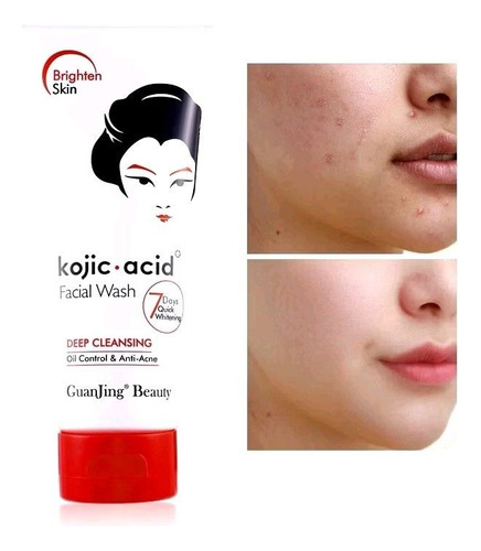 Limpiador Facial Ácido Kojico Antiacne Control Oil Limpieza