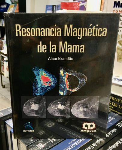 Resonancia Magntica De La Mama,jk