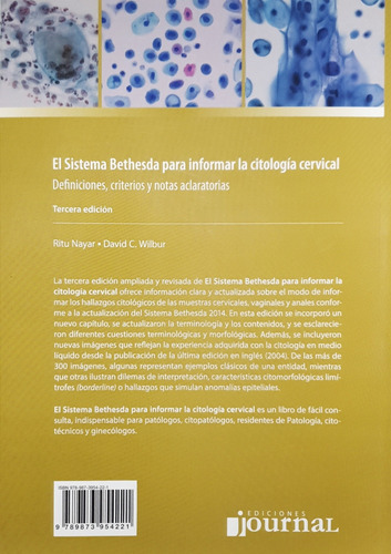 Sistema Bethesda Para Informar La Citologia Cervical Definic