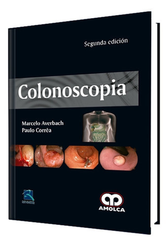Colonoscopia. Segunda Edición, De Marcelo Averbach - Paulo Correa. Editorial Amolca, Tapa Dura, Edición 2ª En Español, 2017