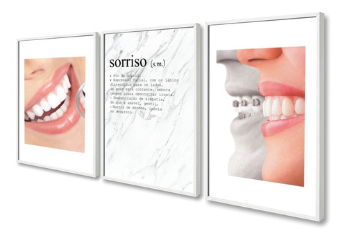 Quadro Decorativo Consultório Dentista Sorriso Frase Moldura