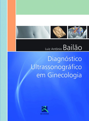 Diagnóstico Ultrassonográfico em Ginecologia, de Bailão, Luiz Antônio. Editora Thieme Revinter Publicações Ltda, capa dura em português, 2015