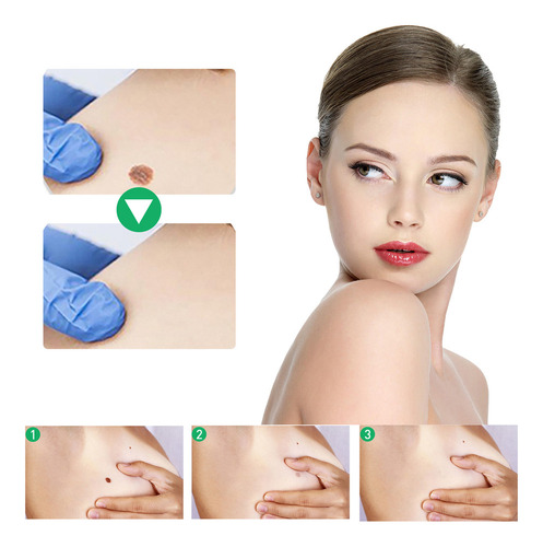 Solución Para Verrugas Y Ojos De Pollo De 10 Ml, 2 Piezas Pa