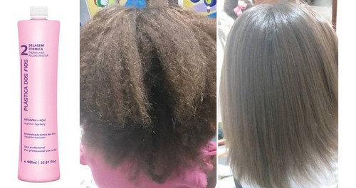 2 Progressiva Plastica Dos Fios E Btox Alisa Cabelos Afro