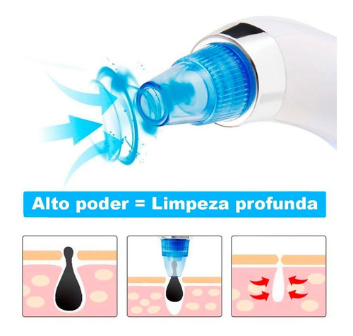 Removedor Vak 356 Puntos Negros Espinillas Fototerapia Acne