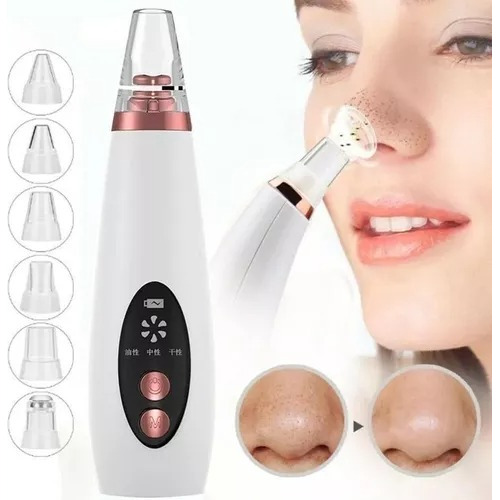 Removedor Puntos Negros Extractor Limpieza Facial Espinillas