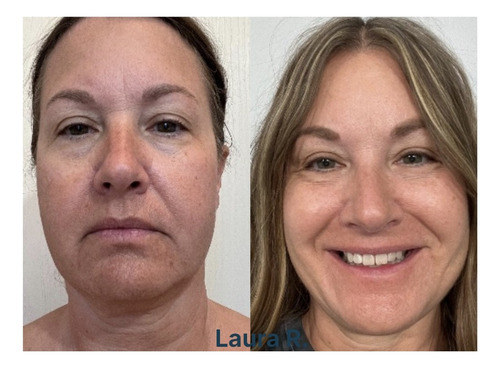 Neora Limpiador Desmaquillante De Rostro Botanico Vegano