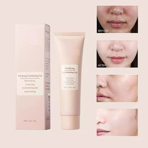 Gel Exfoliante Purificante, Limpiador Exfoliante Facial 3 Pi