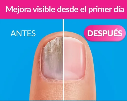 Serum Antihongos Para Uñas - Cura Manos Y Pies 100 Ml Neutra