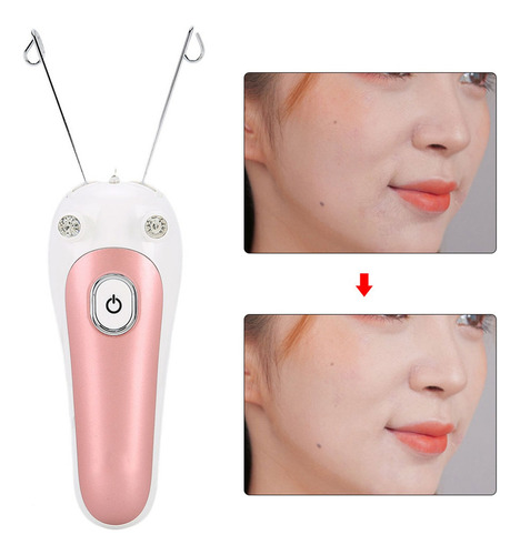 # Removedor Elétrico De Cabelo, Rosto, Corpo, Braço, Perna,
