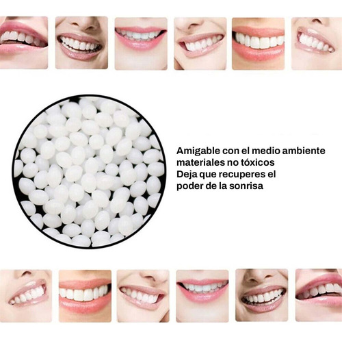 Dientes Postizos Superiores Reutilizables + Blanqueador Fáci