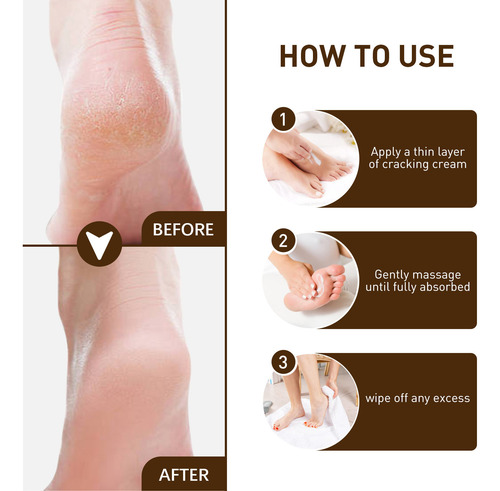 Crema Reparadora K Skin Repair Skin Repara La Piel Agrietada