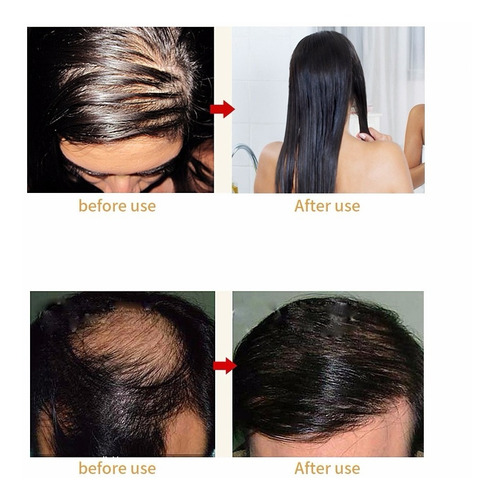 Imagen 8 de 9 de Peine Masajeador Laser Contra La Caida Del Cabello