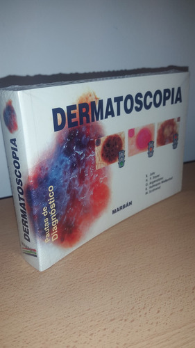 Dermatoscopia Pautas De Diagnóstico Johr