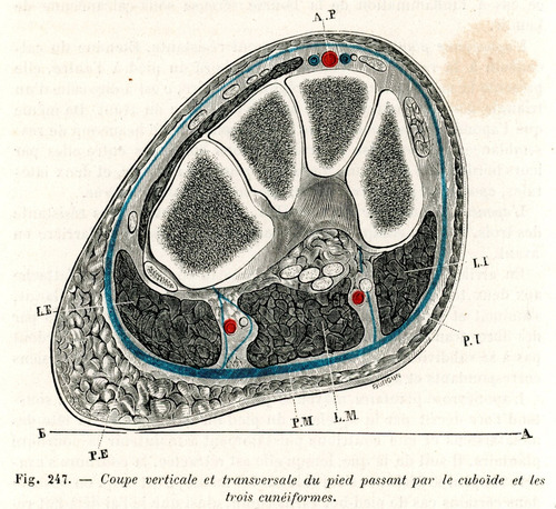Grabado Antiguo Medicina Cuboides Y Cuneiformes Del Pie