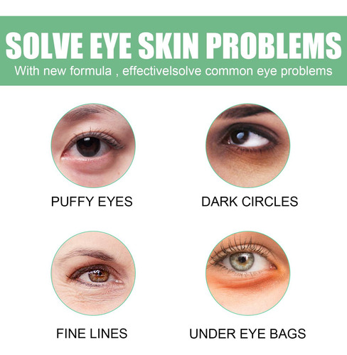 30 Pares De Mascarillas De Aloe Para Debajo De Los Ojos, Sop