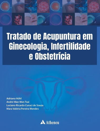 Tratado De Acupuntura Em Ginecologia, Infertilidade E Obst