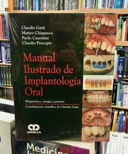 Libro - Manual Ilustrado De Implantología Oral Diag.cirugía.