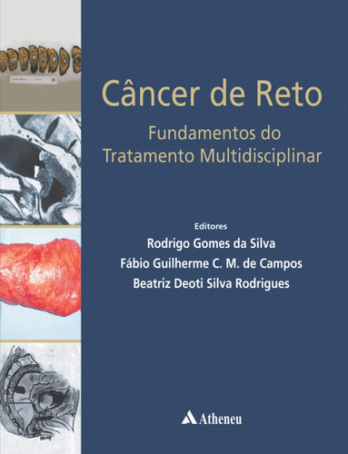 Câncer de reto - fundamentos do tratamento multidisciplinar, de Silva, Rodrigo Gomes da. Editora Atheneu Ltda, capa dura em português, 2017