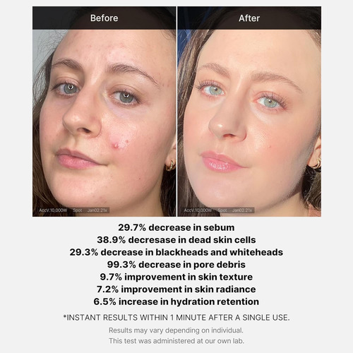 Medicube Red Succinic Acid Booster Serum Rejuvenecedor Madura Noche