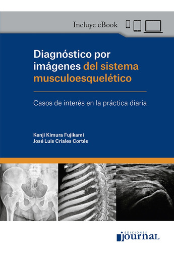 Diagnostico Por Imagenes Del Sistema Musculoesqueletico - Ki