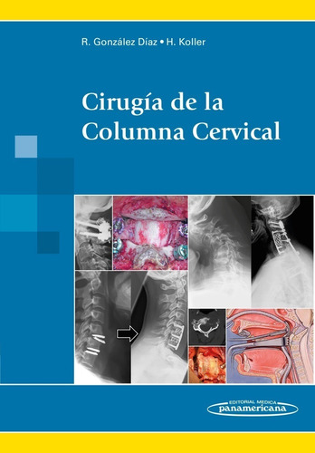 Cirugia De La Columna Cervical Gonzalez Diaz