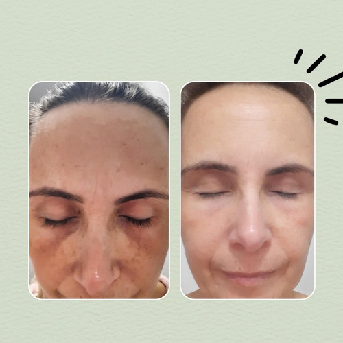 Suplemento Clareador de Melasma e Manchas | Antioxi Nutri Rituária | 90 Cápsulas | Pele Uniforme e Saudável