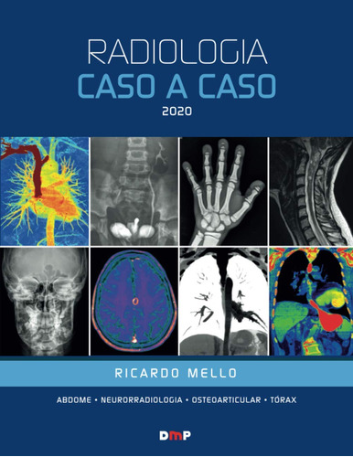 Radiologia Caso A Caso 2020