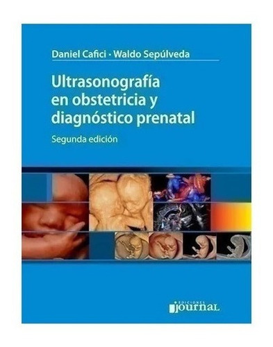 Libro - Ultrasonografía Obstetricia Diagnóstico Prenatal 2ed