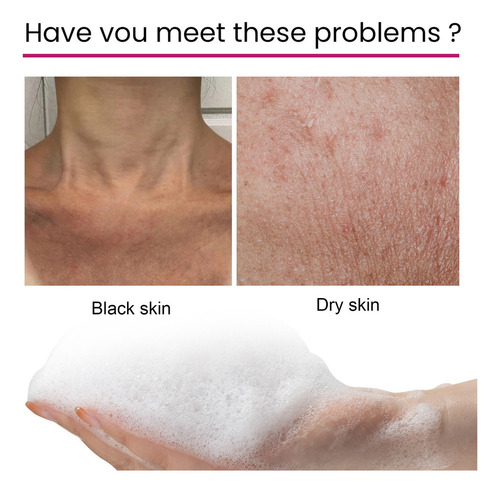 . Sabonete De Beleza Clean Up Melanina, Pele Achatada,