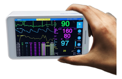Monitor Veterinario De Signos Vitales Portátil de 5 Parametros NIBP, SpO2, ECG, PR, TEMP Recargable Con Pantalla Touch 5.5 pulgadas - Marca Choisemed