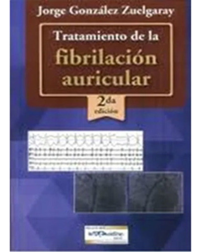 Tratamiento De La Fibrilacion Auricular 