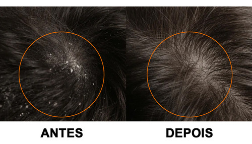 Shampoo Anticaspa Nerk Therapy Embaixador 240ml