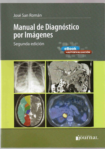 San Roman Manual Diagnostico Imagenes Libro Nuevo