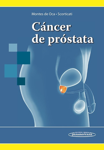 Cancer De Prostata  - Montes De Oca