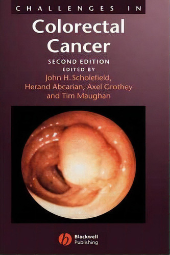 Challenges In Colorectal Cancer, De John Scholefield. Editorial John Wiley Sons Ltd, Tapa Dura En Inglés