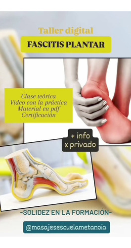 Taller Digital: Fascitis Plantar