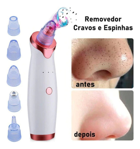 Removedor De Cravos Sugador Espinhas Poros Elétrico Peeling