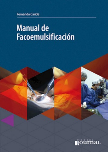 Manual De Facoemulsificacion. Caride