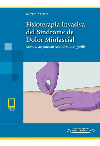 Fisioterapia Invasiva Del Síndrome De Dolor Miofascial Noved