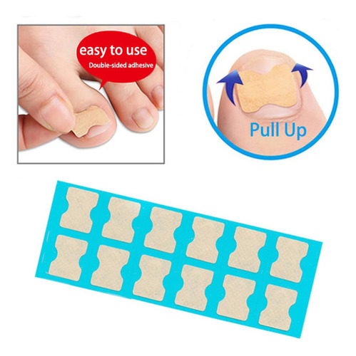 Corrección De Uñas Elásticas Pegatinas Corrector 48 Hojas