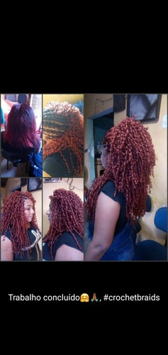 Imagem 1 de 5 de Estética