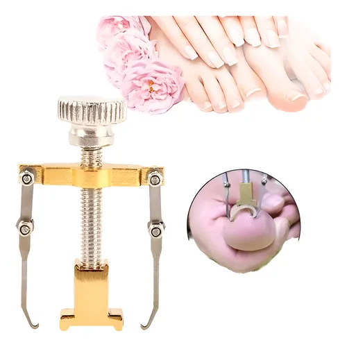 Corrector Levantador De Uñas Encarnada Pies Metalico Encarna