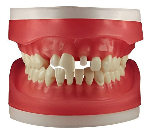 Refil Manequim De Materiais Dentarios Ac100 - Pronew